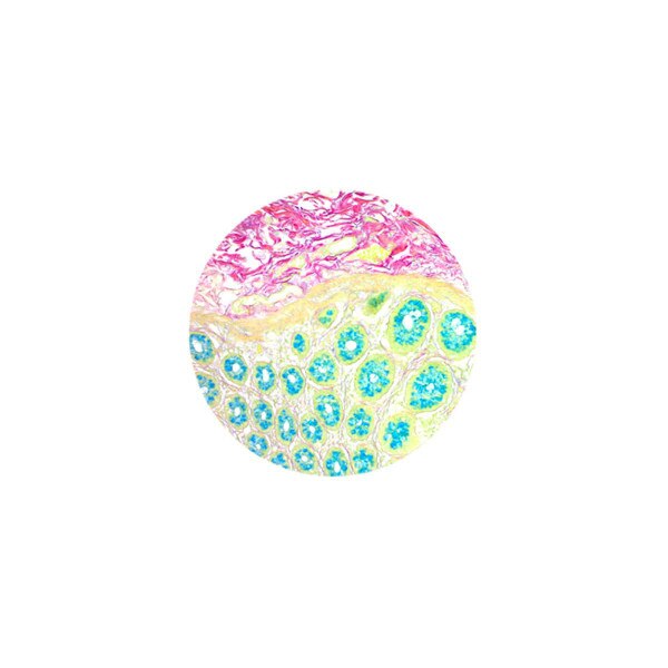 Colloidal Iron Stain Kit